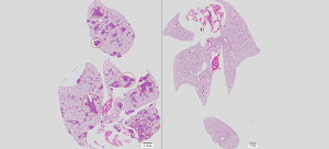 Survival mechanism of metastatic cancer cell revealed